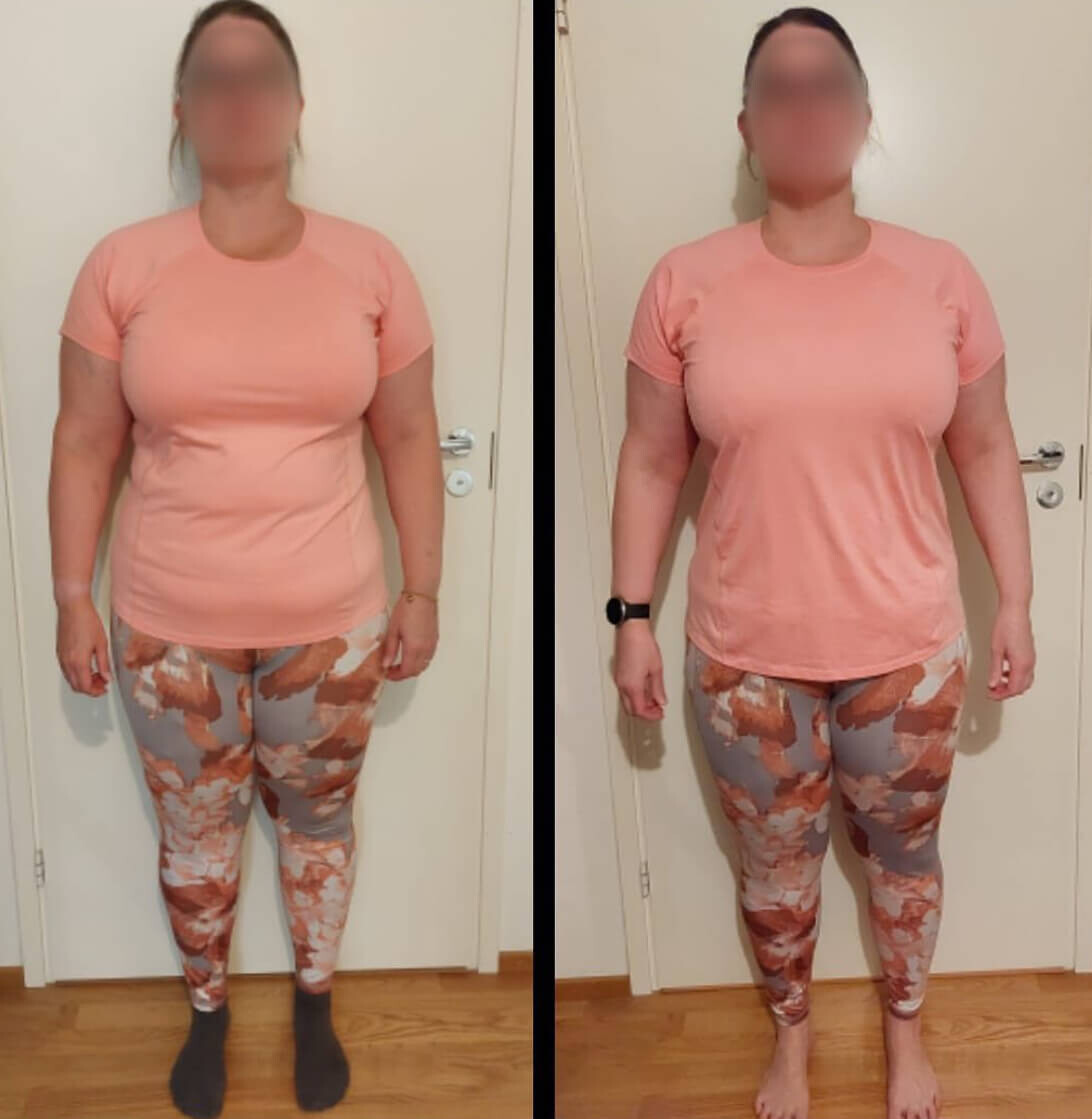 Painonpudotus avuksi lapsettomuushoidoissa